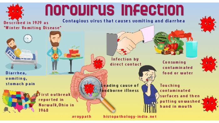 Симптомы норовируса. Норовирусная инфекция. Норовирус у детей. Норовирусная инфекция у детей.