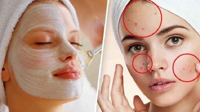 9 Cara Alami Hilangkan Flek Hitam di Wajah Tanpa Perlu Skincare Mahal
